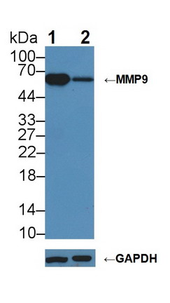 Polyclonal Antibody to Matrix Metalloproteinase 9 (MMP9)