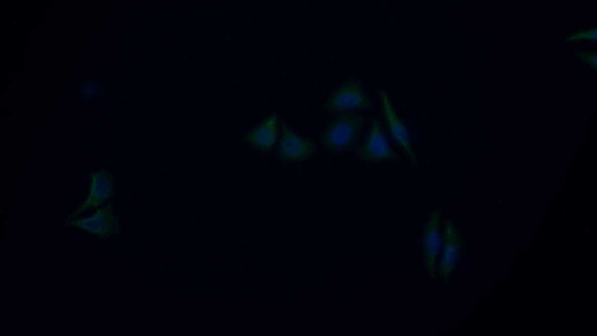 Polyclonal Antibody to Matrix Metalloproteinase 9 (MMP9)