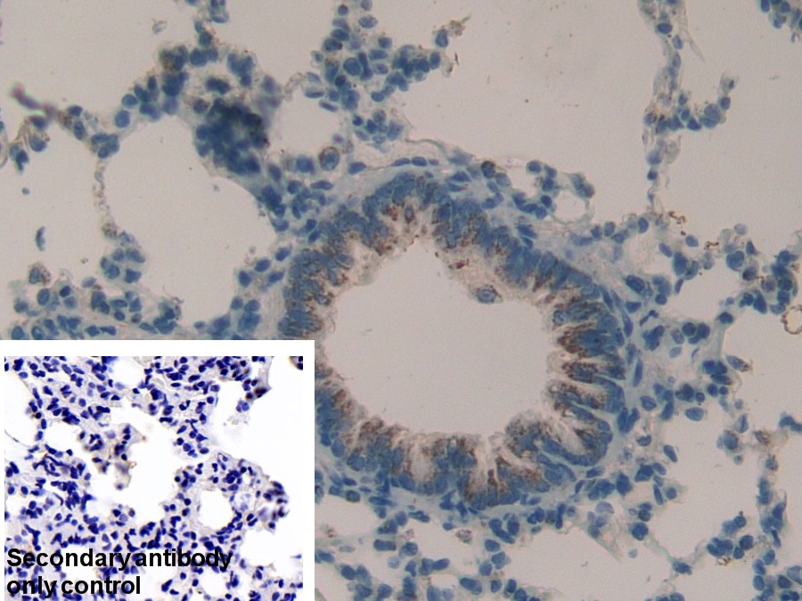 Polyclonal Antibody to Matrix Metalloproteinase 9 (MMP9)