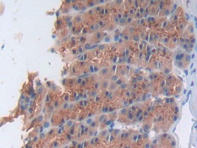 Polyclonal Antibody to Nicotinamide Adenine Dinucleotide Phosphate Oxidase 1 (NOX1)