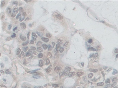 Polyclonal Antibody to Nicotinamide Adenine Dinucleotide Phosphate Oxidase 5 (NOX5)