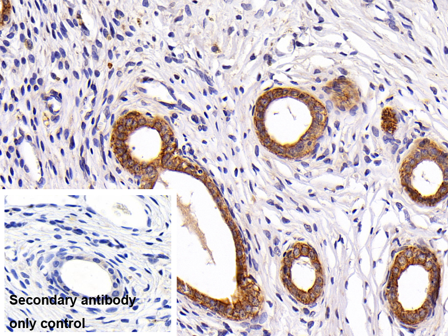Polyclonal Antibody to Cytokeratin 7 (CK7)