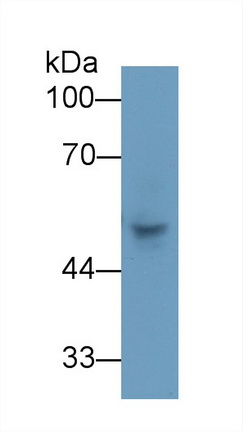 Polyclonal Antibody to Cytokeratin 7 (CK7)