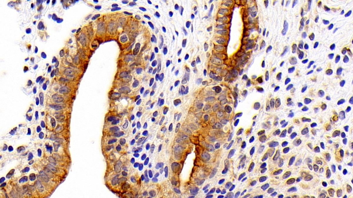 Polyclonal Antibody to Cytokeratin 7 (CK7)