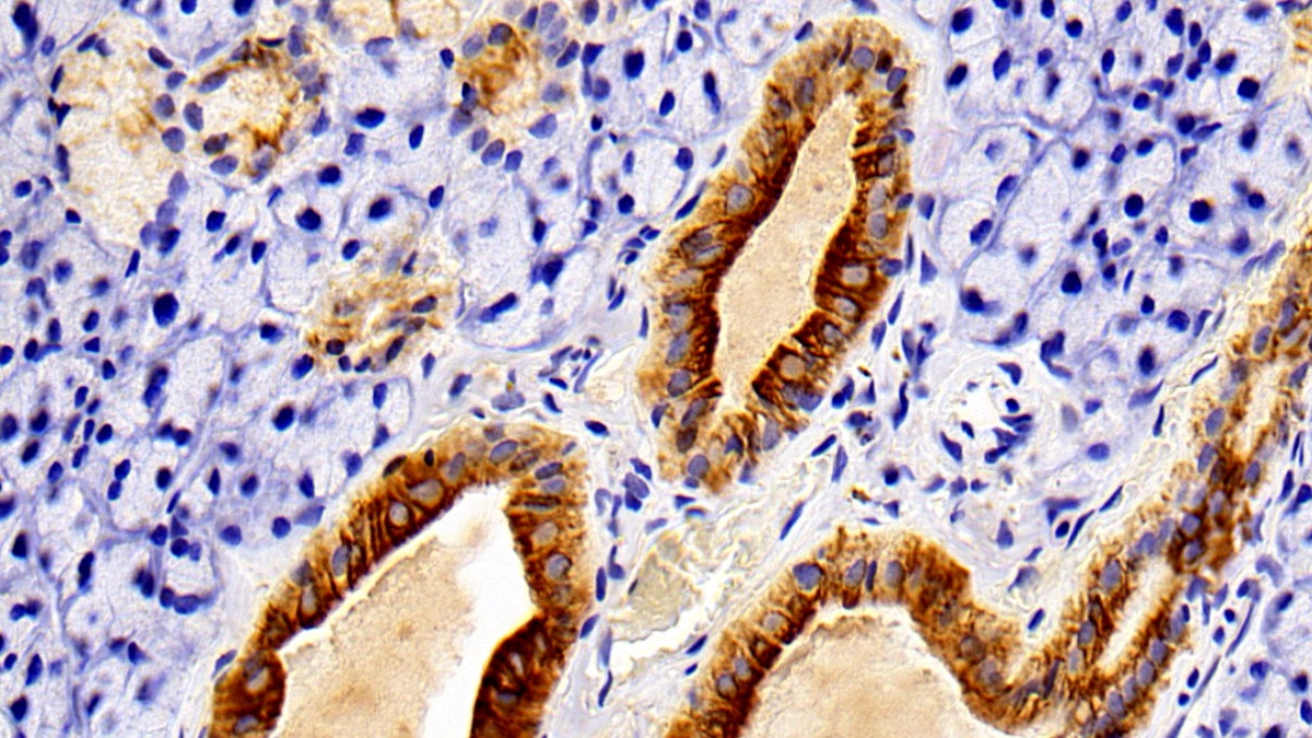 Polyclonal Antibody to Cytokeratin 7 (CK7)