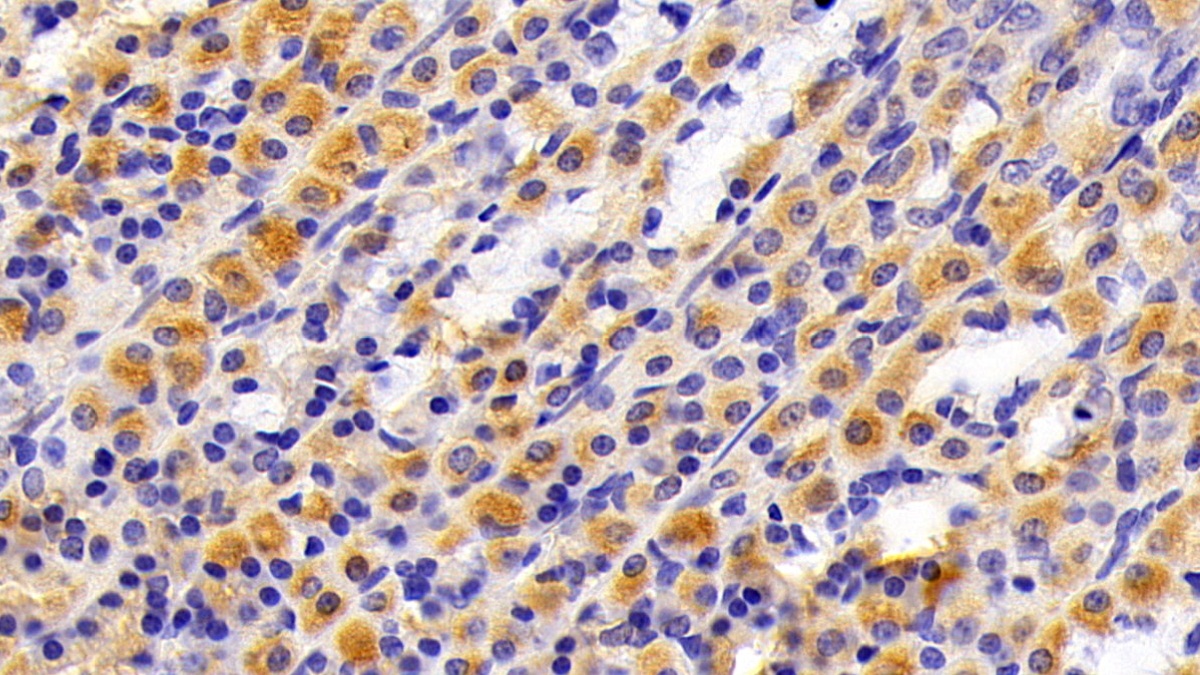 Polyclonal Antibody to Cytokeratin 7 (CK7)