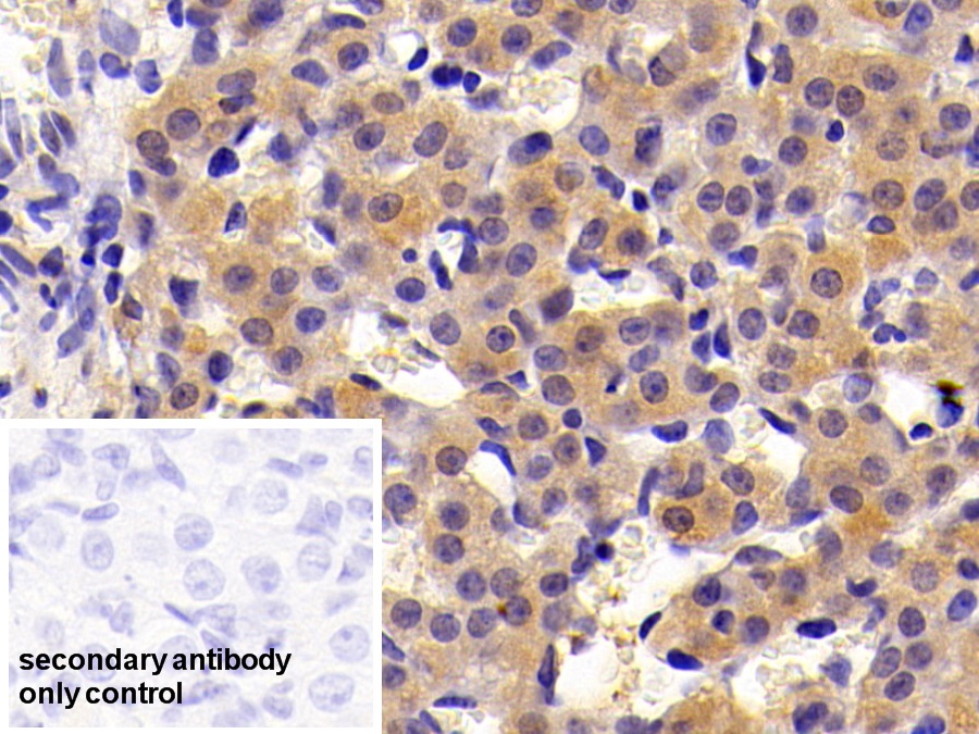 Polyclonal Antibody to Cytokeratin 7 (CK7)