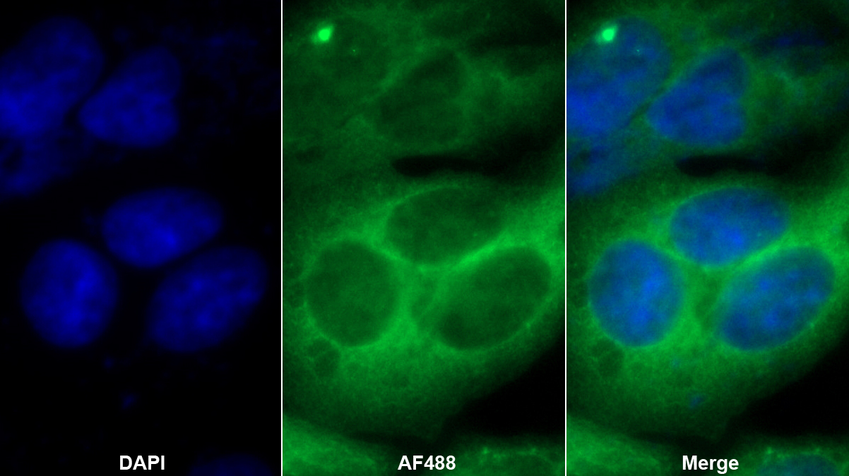 Polyclonal Antibody to Cytokeratin 7 (CK7)