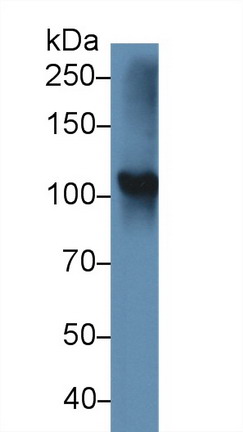 Polyclonal Antibody to Thyroid Peroxidase (TPO)