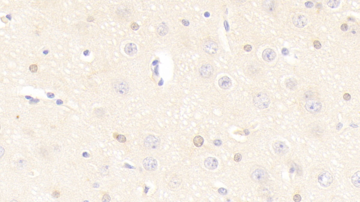 Polyclonal Antibody to Fatty Acid Binding Protein 2, Intestinal (FABP2)