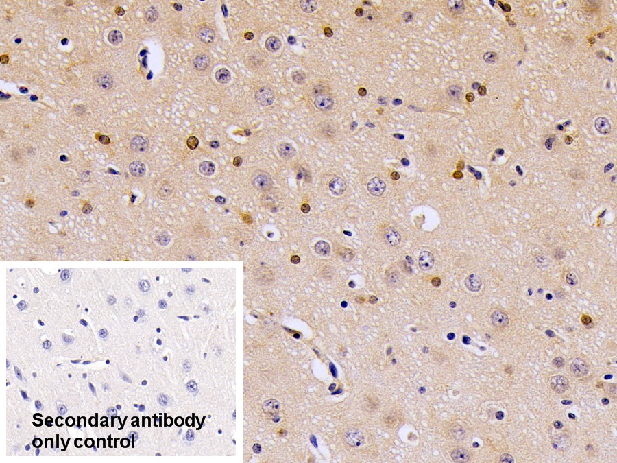 Polyclonal Antibody to Fatty Acid Binding Protein 2, Intestinal (FABP2)