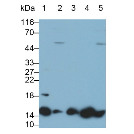 Polyclonal Antibody to Fatty Acid Binding Protein 2, Intestinal (FABP2)