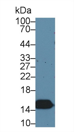 Polyclonal Antibody to Fatty Acid Binding Protein 2, Intestinal (FABP2)