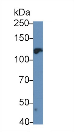 Polyclonal Antibody to Leukemia Inhibitory Factor Receptor (LIFR)