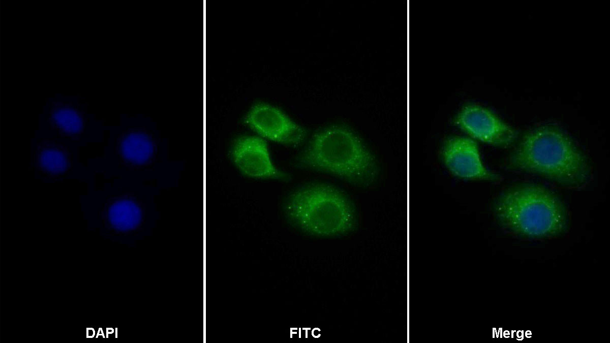 Polyclonal Antibody to Leukemia Inhibitory Factor Receptor (LIFR)