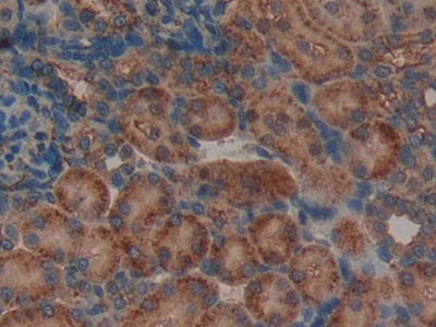 Polyclonal Antibody to Leukemia Inhibitory Factor Receptor (LIFR)