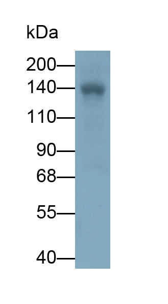 Polyclonal Antibody to Leukemia Inhibitory Factor Receptor (LIFR)