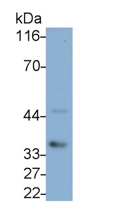 Polyclonal Antibody to Interleukin 1 Beta (IL1b)