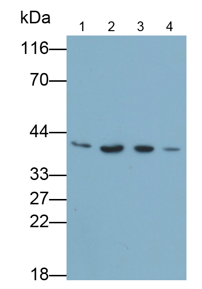 Polyclonal Antibody to Interleukin 1 Beta (IL1b)