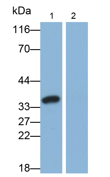 Polyclonal Antibody to Interleukin 1 Beta (IL1b)