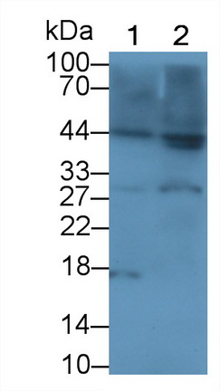 Polyclonal Antibody to Interleukin 1 Beta (IL1b)