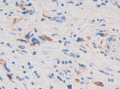 Polyclonal Antibody to Interleukin 1 Delta (FIL1d)