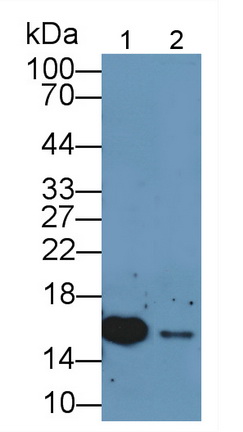 Polyclonal Antibody to S100 Calcium Binding Protein A11 (S100A11)