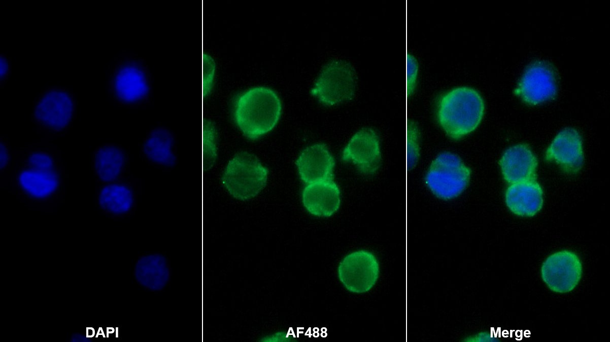 Polyclonal Antibody to P-Selectin (SELP)