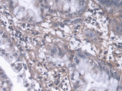 Polyclonal Antibody to Procollagen III N-Terminal Propeptide (PIIINP)