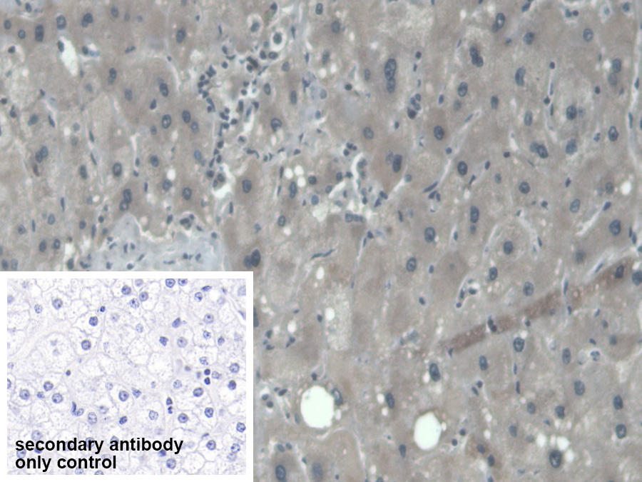 Polyclonal Antibody to Procollagen III N-Terminal Propeptide (PIIINP)