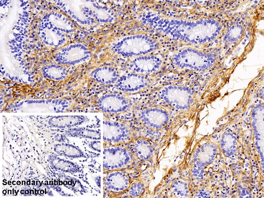 Polyclonal Antibody to Procollagen III N-Terminal Propeptide (PIIINP)