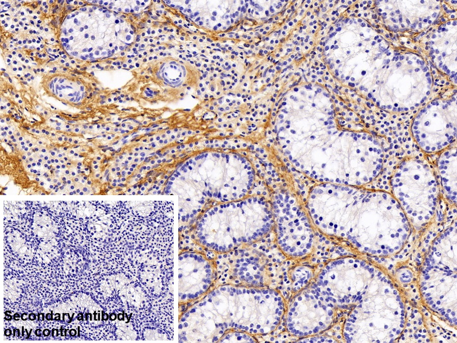 Polyclonal Antibody to Procollagen III N-Terminal Propeptide (PIIINP)