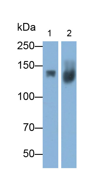 Polyclonal Antibody to Procollagen III N-Terminal Propeptide (PIIINP)