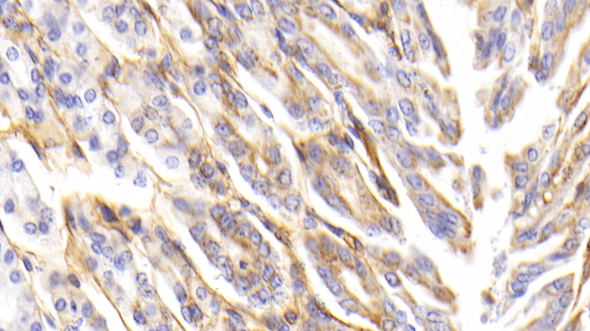 Polyclonal Antibody to Procollagen III N-Terminal Propeptide (PIIINP)