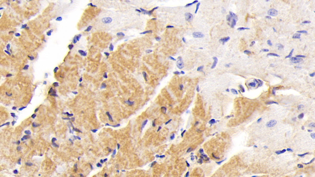 Polyclonal Antibody to Procollagen III N-Terminal Propeptide (PIIINP)