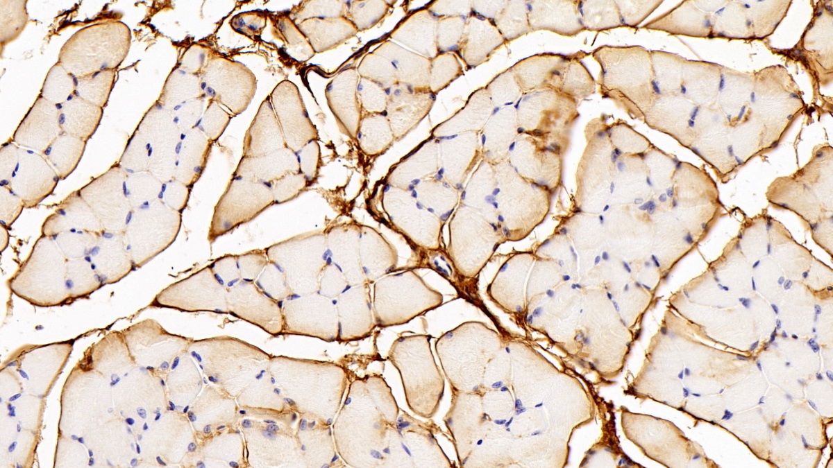 Polyclonal Antibody to Procollagen III N-Terminal Propeptide (PIIINP)