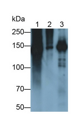 Polyclonal Antibody to Procollagen III N-Terminal Propeptide (PIIINP)