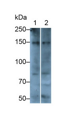 Polyclonal Antibody to Procollagen III N-Terminal Propeptide (PIIINP)