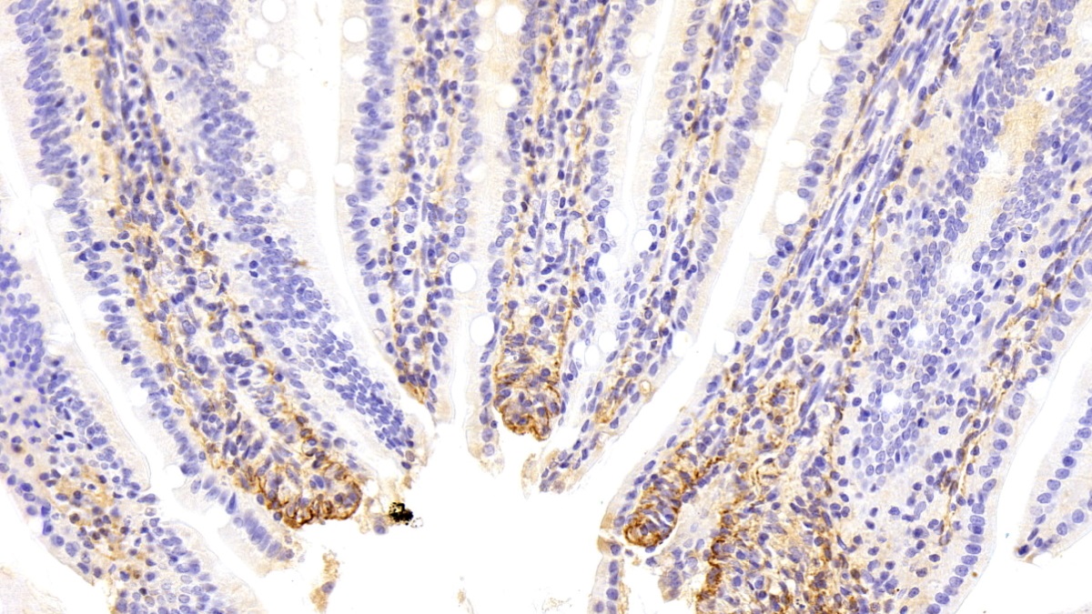 Polyclonal Antibody to Procollagen III N-Terminal Propeptide (PIIINP)