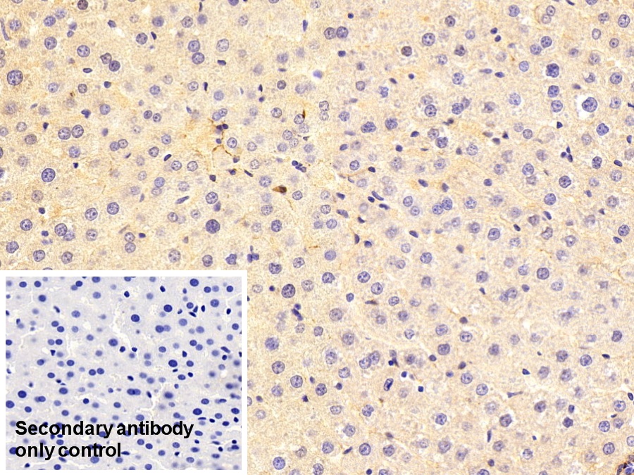 Polyclonal Antibody to Procollagen III N-Terminal Propeptide (PIIINP)