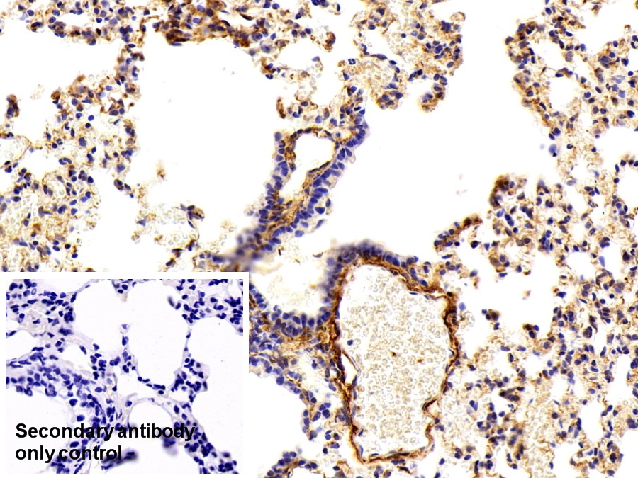 Polyclonal Antibody to Procollagen III N-Terminal Propeptide (PIIINP)