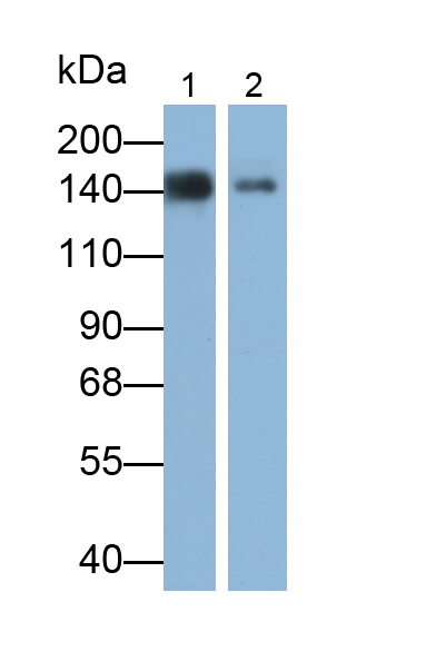 Polyclonal Antibody to Procollagen III N-Terminal Propeptide (PIIINP)