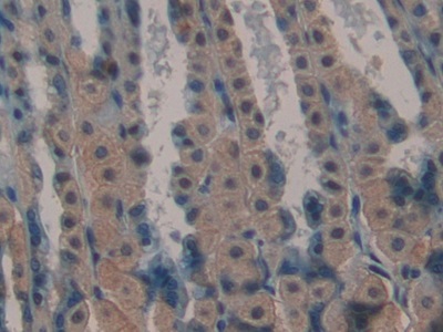 Polyclonal Antibody to Laminin Alpha 1 (LAMA1)