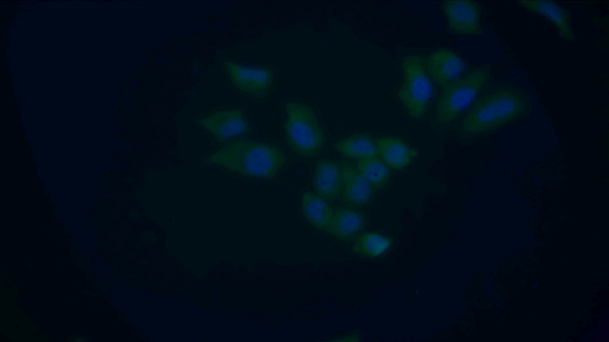 Polyclonal Antibody to Phospholipase A2 Activating Protein (PLAP)