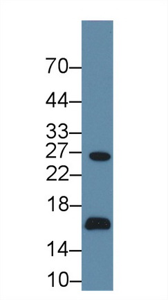 Polyclonal Antibody to Aquaporin 2, Collecting Duct (AQP2)