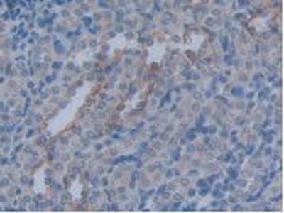 Polyclonal Antibody to Aquaporin 4 (AQP4)