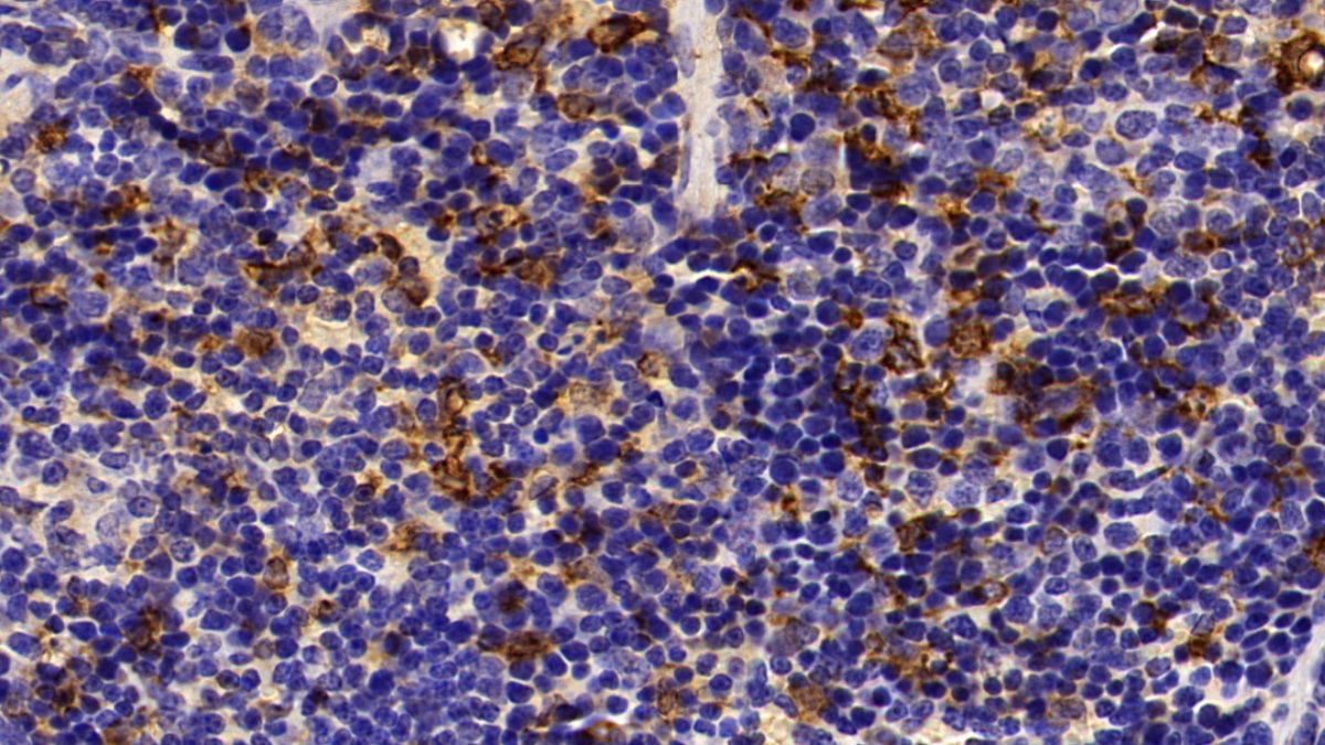 Polyclonal Antibody to Heme Oxygenase 1 (HO1)