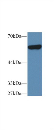 Polyclonal Antibody to Pyruvate kinase isozymes M2 (PKM2)