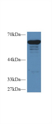 Polyclonal Antibody to Pyruvate kinase isozymes M2 (PKM2)