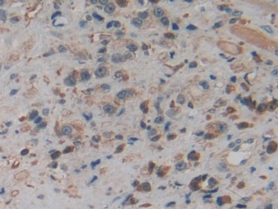 Polyclonal Antibody to Pyruvate kinase isozymes M2 (PKM2)